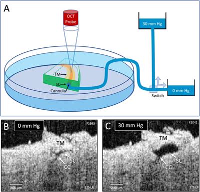 Valve-Like Outflow System Behavior With Motion Slowing in Glaucoma Eyes: Findings Using a Minimally Invasive Glaucoma Surgery–MIGS-Like Platform and Optical Coherence Tomography Imaging